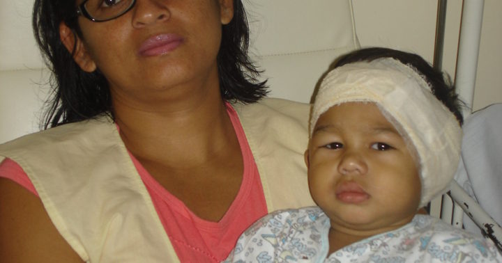Kadu após a cirurgia, com 1 ano, usando o curativo de turbante, no colo da mamãe Debora