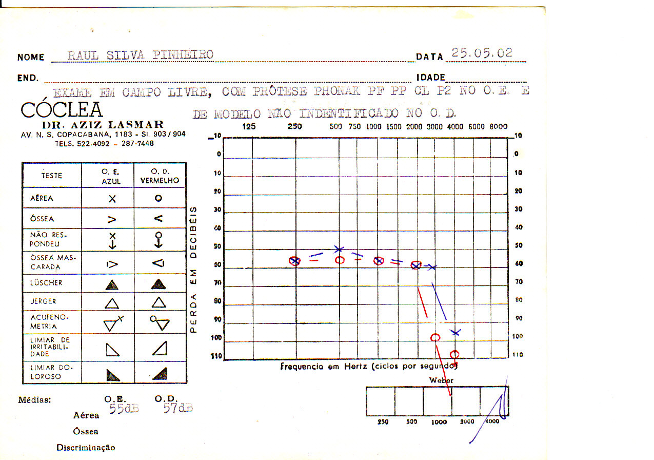 Como Interpretar O Resultado Da Audiometria – Parte 1 – Desculpe, Não Ouvi!