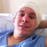 imagem do Marcelo deitado no leito hospitalar, vestindo avental e com um curativo em forma de turbante, que protege a orelha onde foi inserido o implante coclear