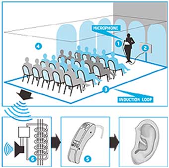 Esquema de Hearing Loop